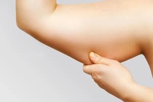 Arm Lift Treatment