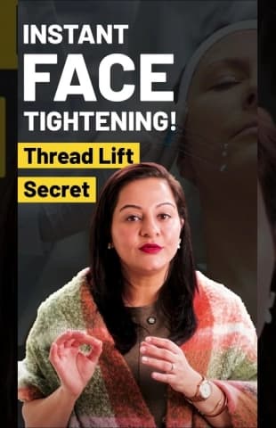 Thread Lift — Natural Face Lift Without Surgery