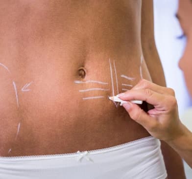 How Body Contouring Helps You Achieve a Toned Look Before the Festive Season
