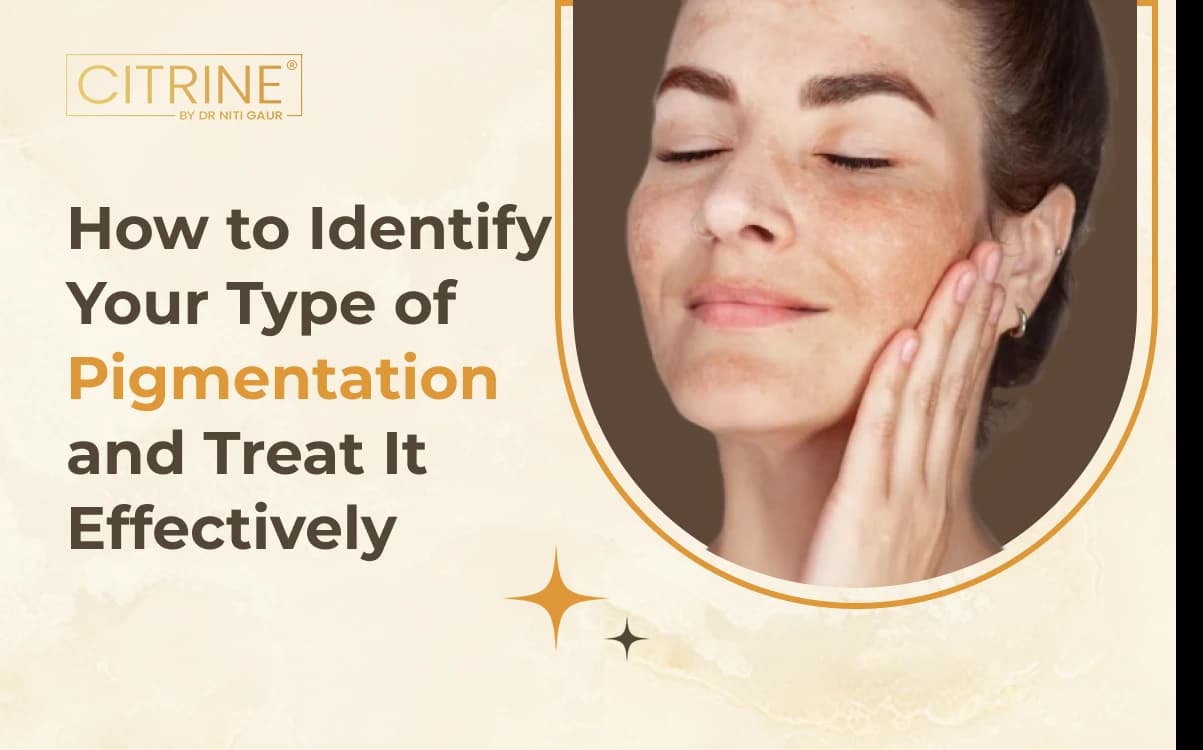 How to Identify Your Type of Pigmentation and Treat It Effectively