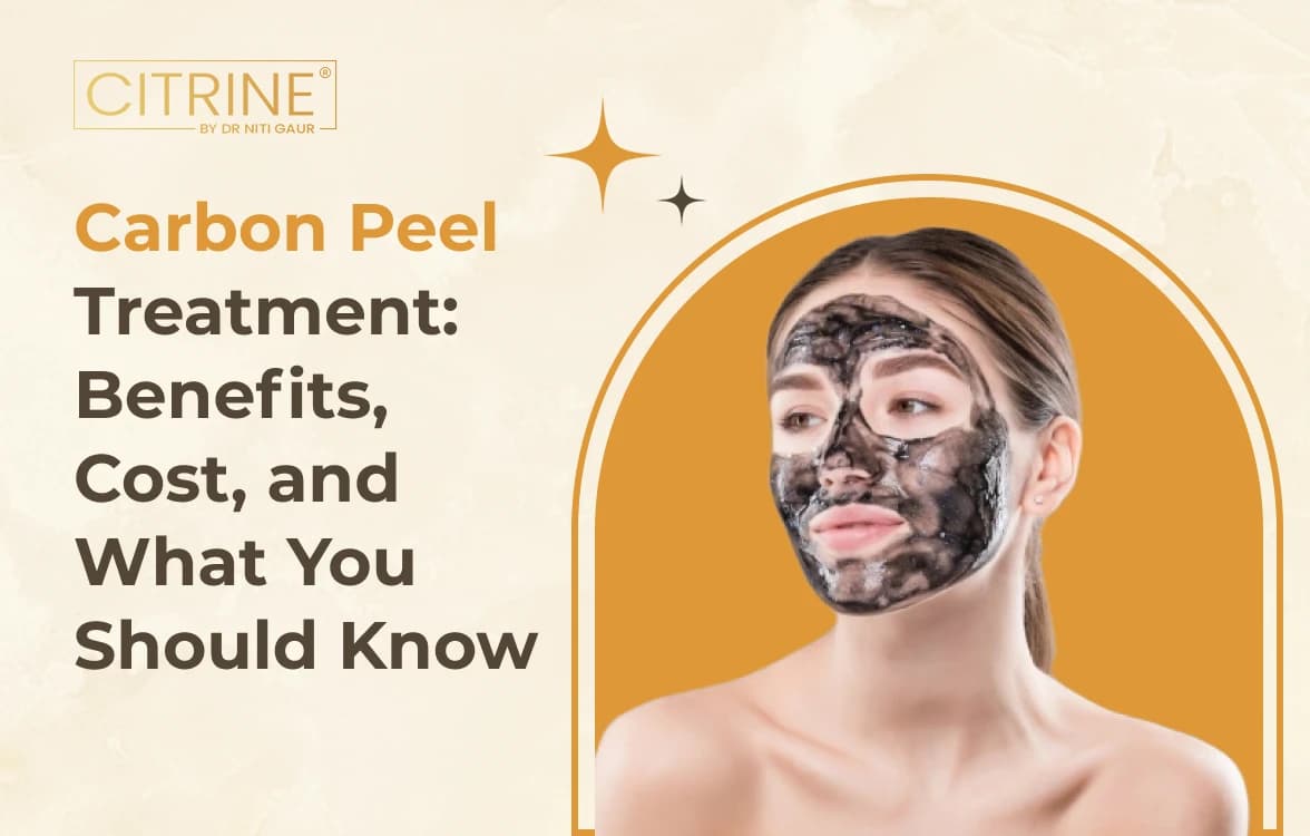 Carbon Peel Treatment: Benefits, Cost, and What You Should Know