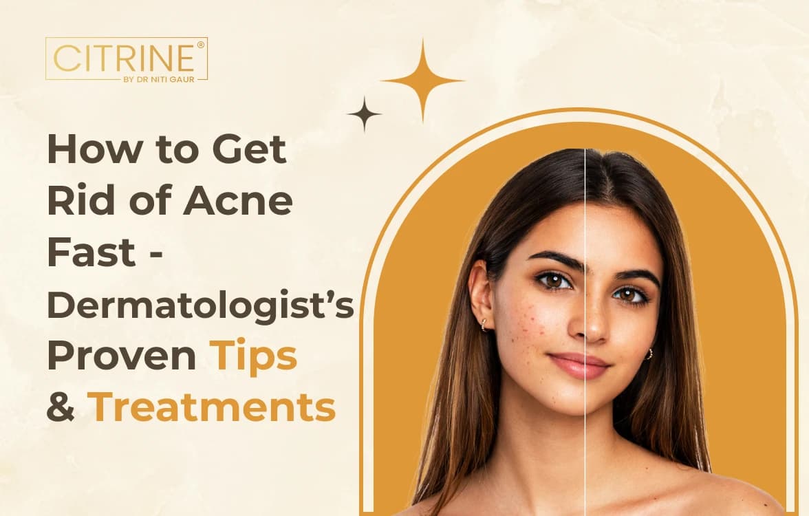 How to Get Rid of Acne Fast - Dermatologist’s Proven Tips and Treatments