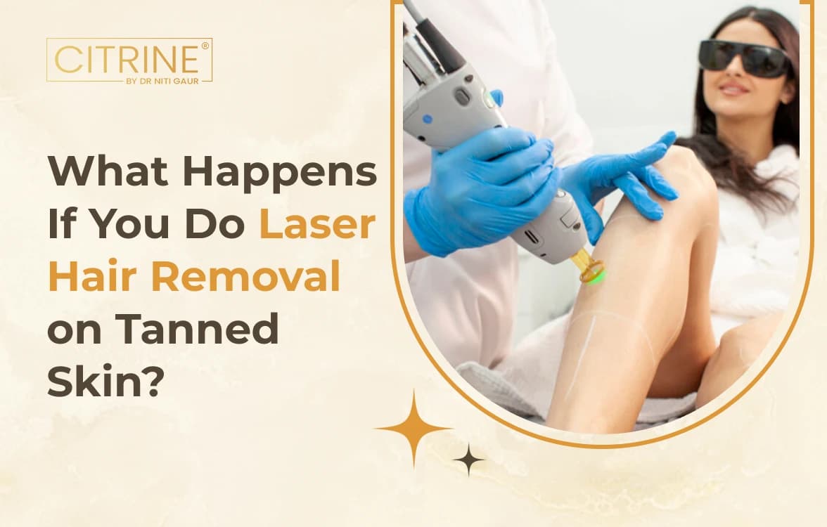 What Happens If You Get Laser Hair Removal on Tanned Skin?