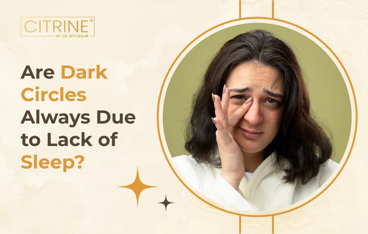 Are Dark Circles Always Due to Lack of Sleep?