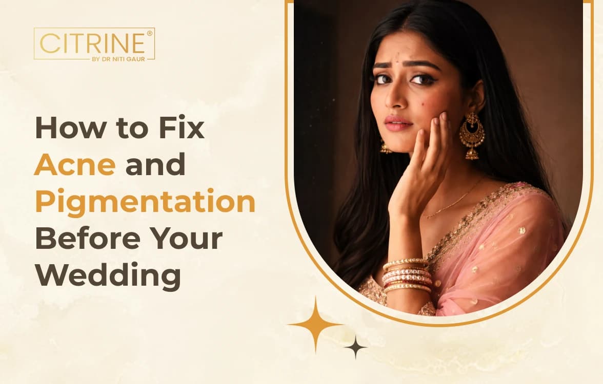 How to Fix Acne and Pigmentation Before Your Wedding