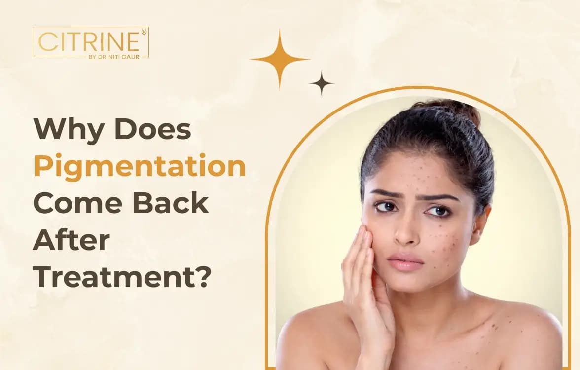 Why Does Pigmentation Come Back After Treatment?