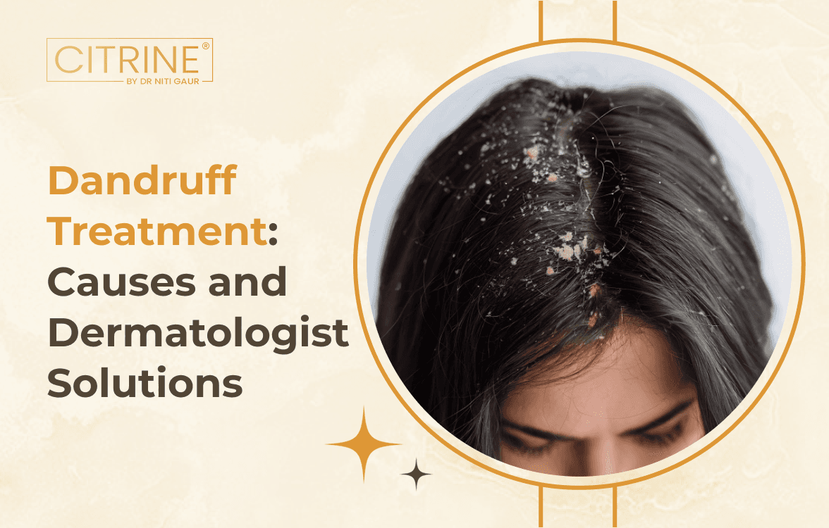 Dandruff Treatment: Causes and Dermatologist Solutions