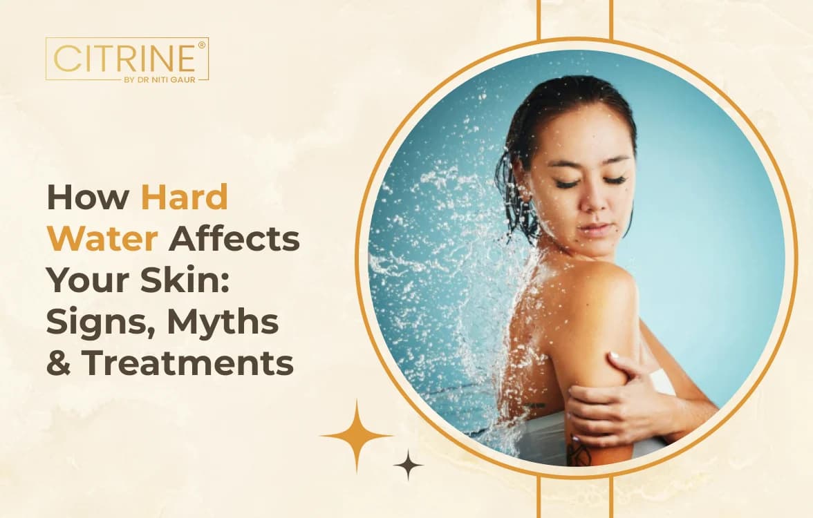 How Hard Water Affects Your Skin: Signs, Myths & Treatments