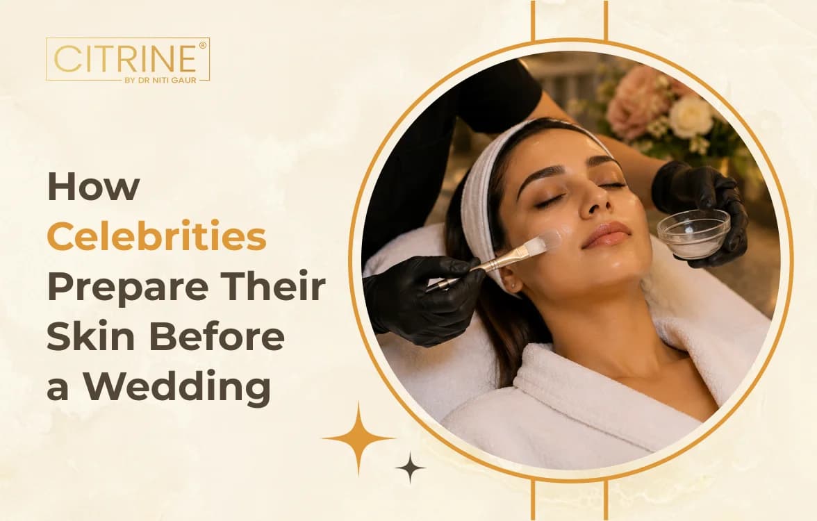 How Celebrities Prepare Their Skin Before a Wedding