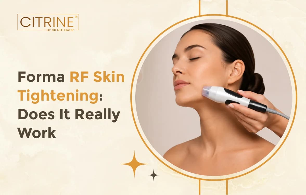Forma RF Skin Tightening: Does It Really Work?