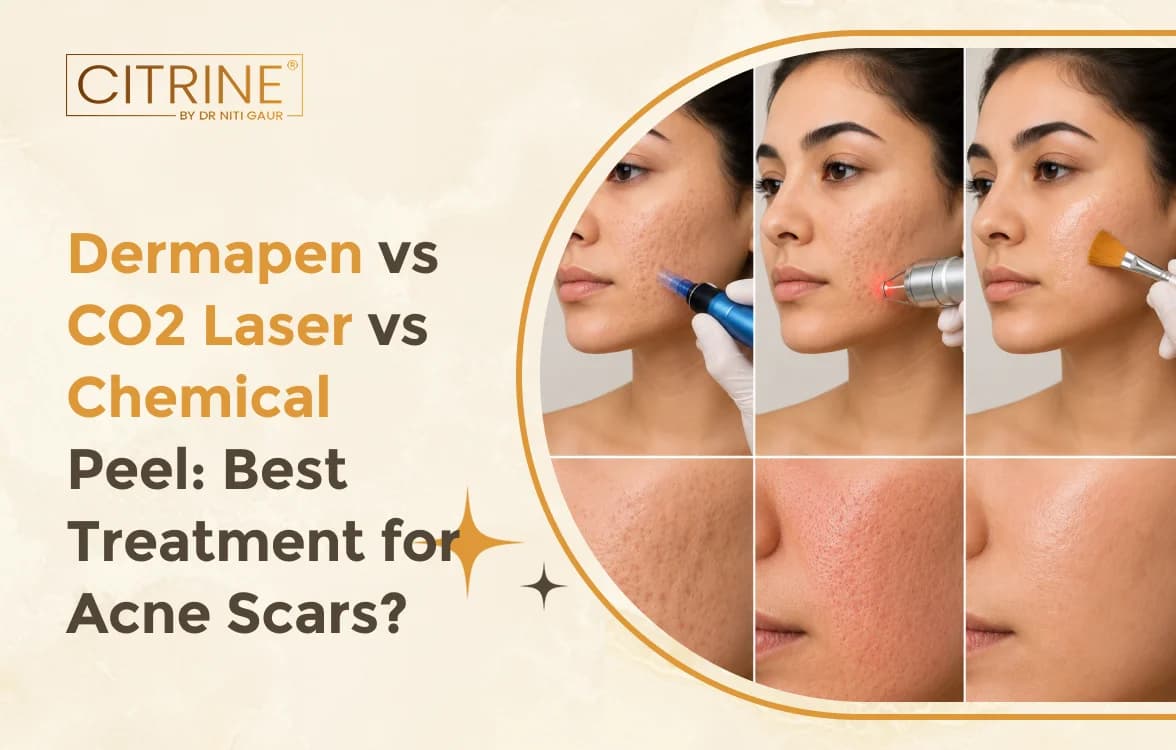 Dermapen vs CO2 Laser vs Chemical Peel: Best Treatment for Acne Scars?