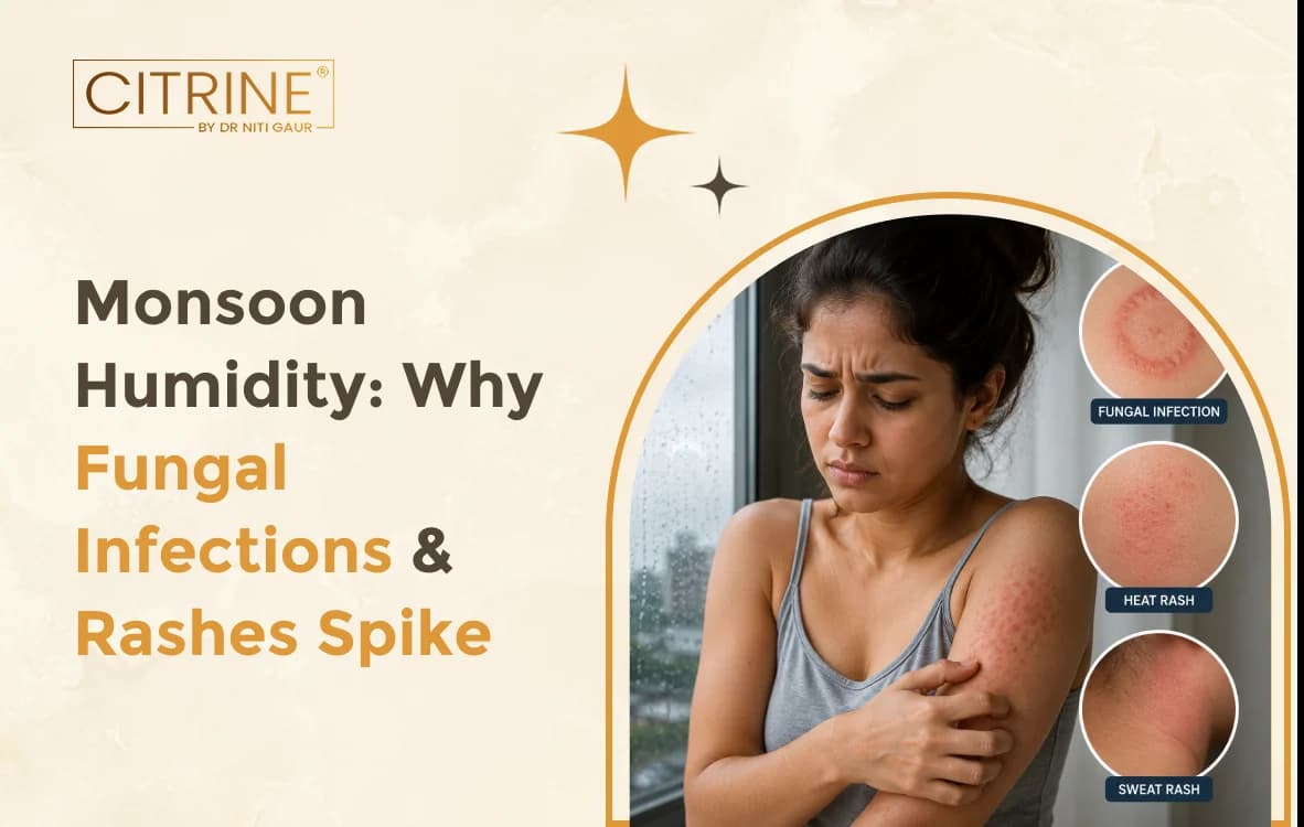 Monsoon Humidity: Why Fungal Infections & Rashes Spike