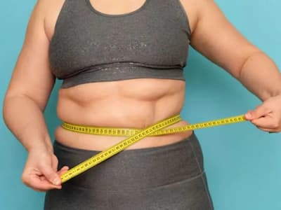 Stretch marks and lose skin when losing weight