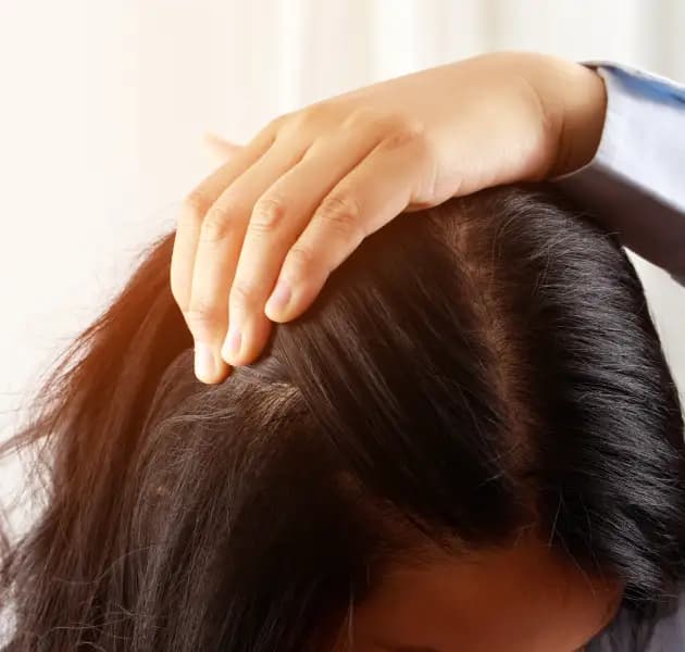 Oily scalp
