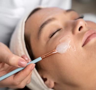 Are Chemical Peels Safe for Acne-Prone Skin? Dermatologist Answers