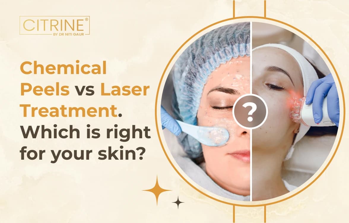 Chemical Peels vs Laser Treatment. Which is right for your skin?