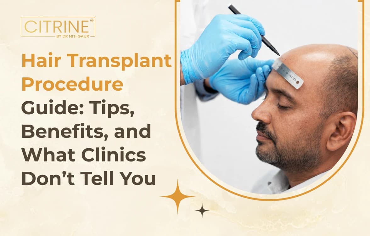 Hair Transplant Procedure Guide: Tips, Benefits, and What Clinics Don’t Tell You