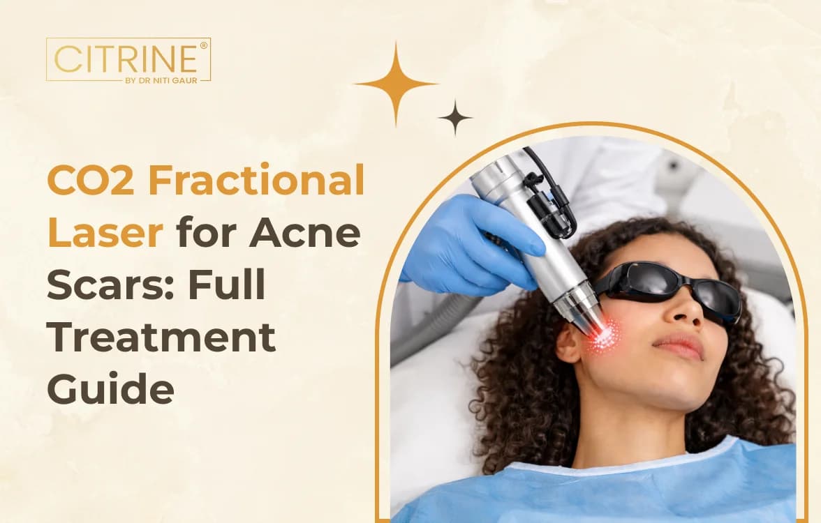 CO2 Fractional Laser for Acne Scars: Full Treatment Guide