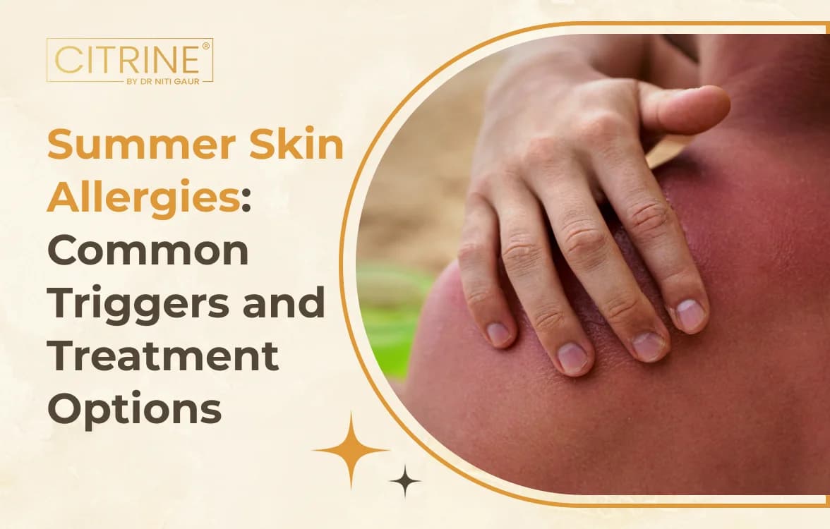 Summer Skin Allergies: Common Triggers and Treatment Options