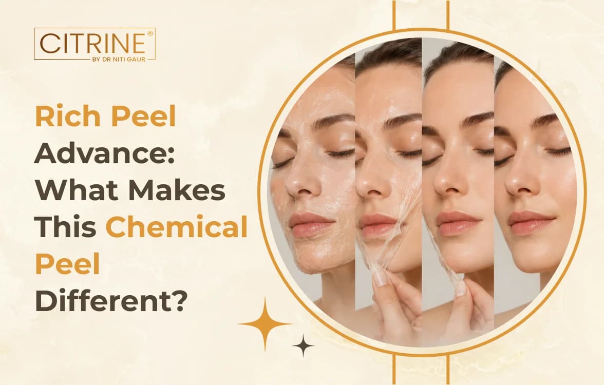Rich Peel Advance: What Makes This Chemical Peel Different?