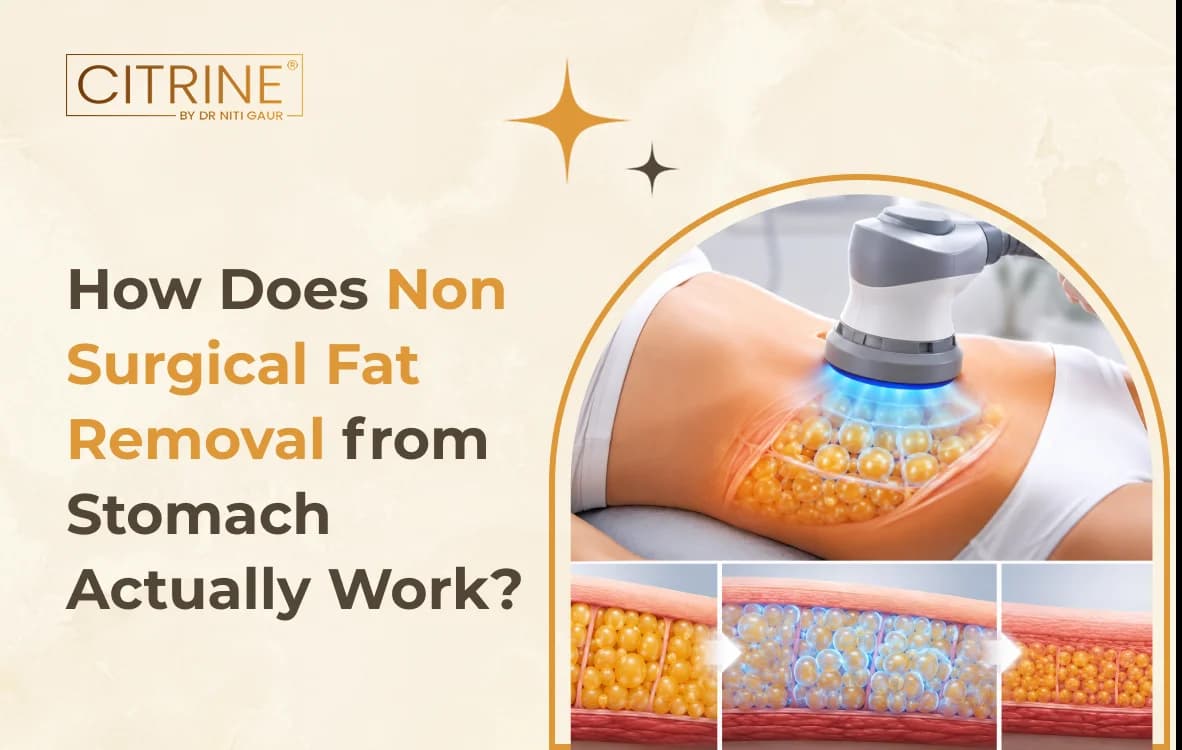 How Does Non Surgical Fat Removal from Stomach Actually Work?