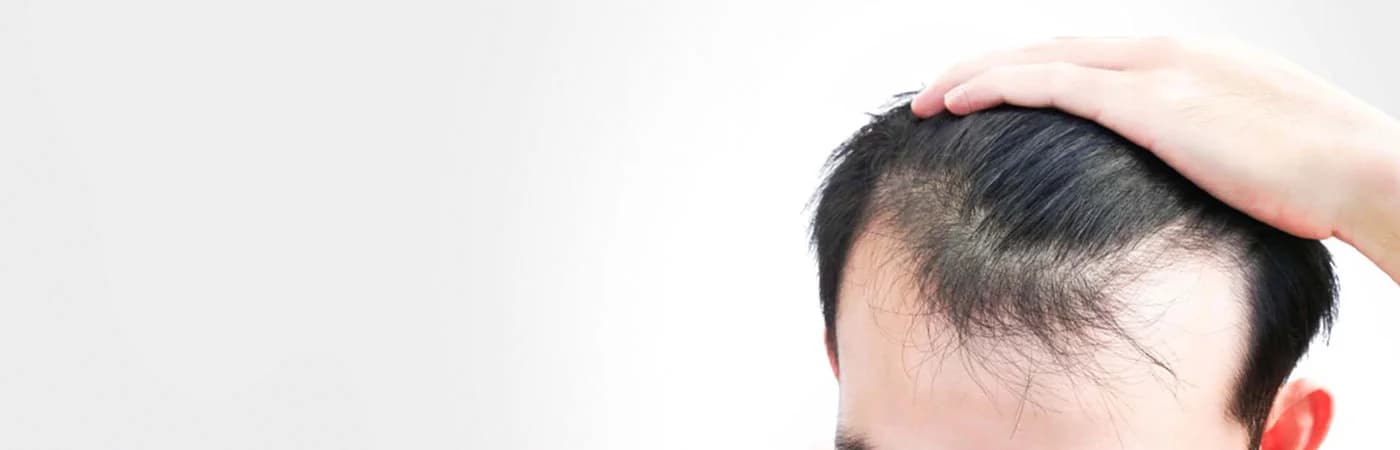 FUE Hair Transplant