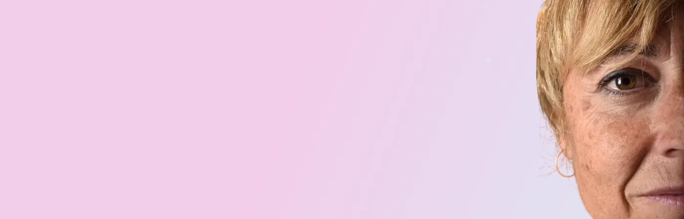 Age spots and pigmentation