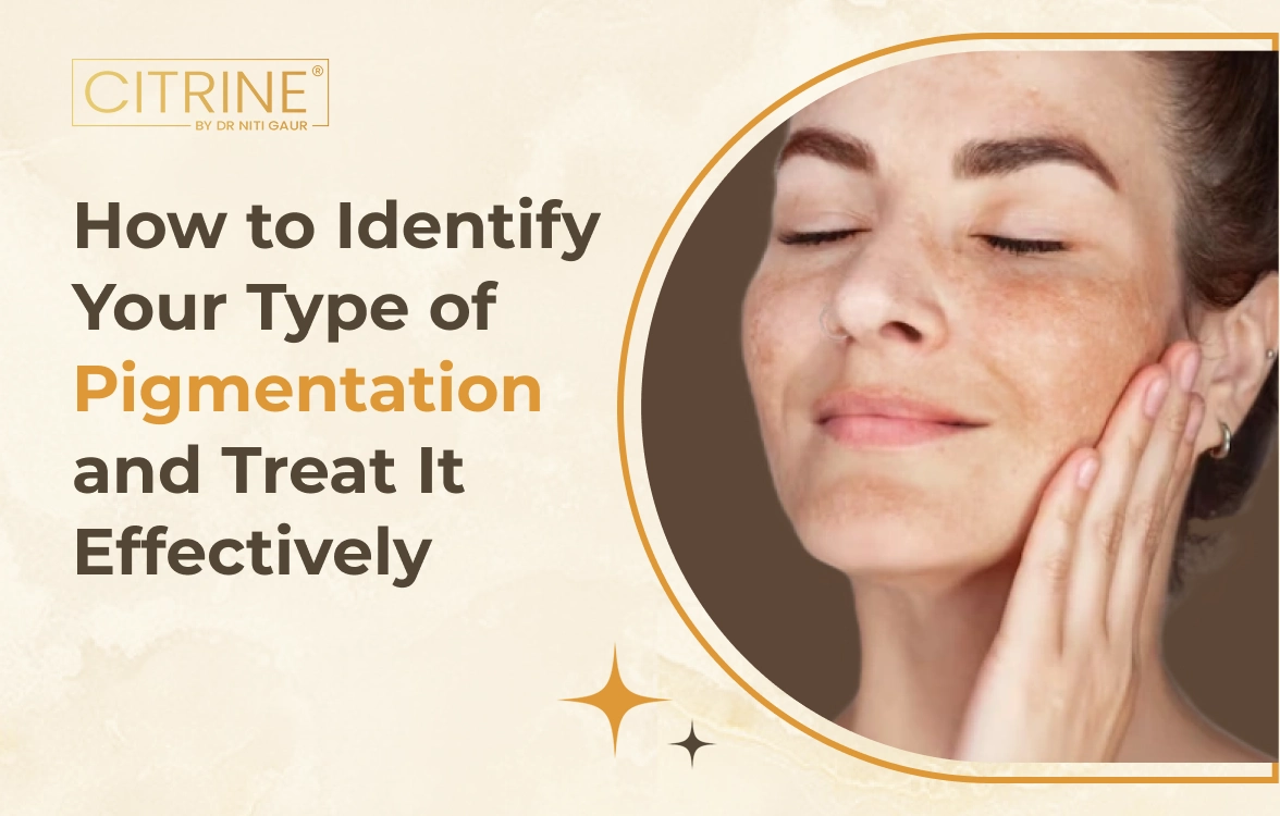Fungal Acne vs Bacterial Acne: How to Spot the Difference