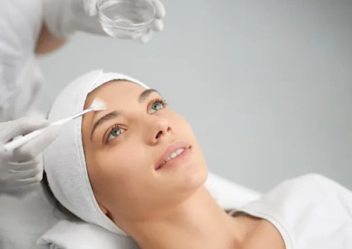 Chemical peels