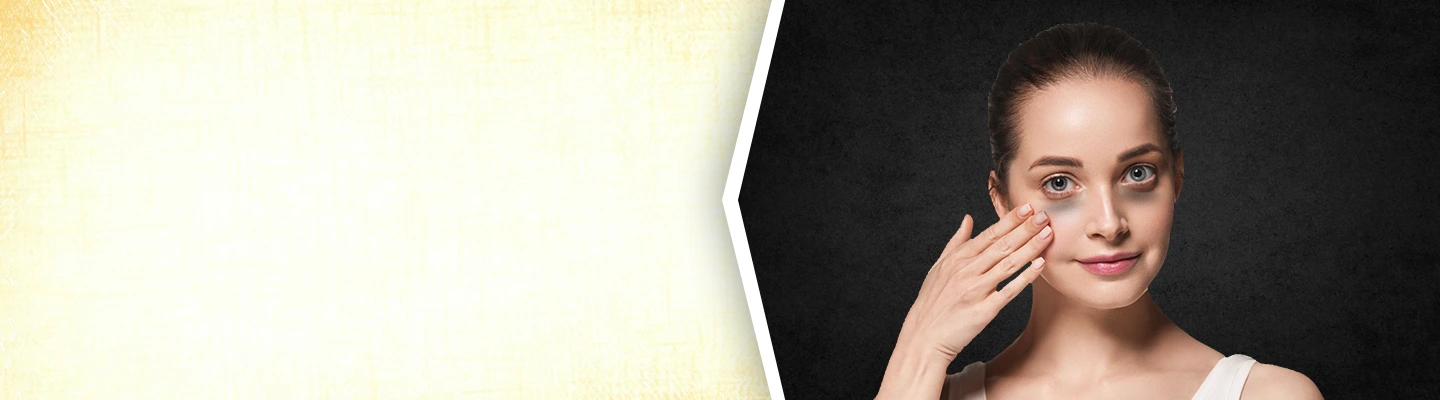 Dark Circles Treatments