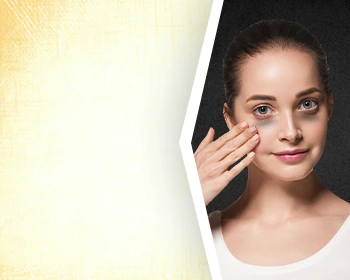 Dark Circles Treatments
