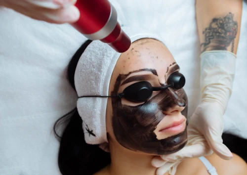 Carbon Laser Facial