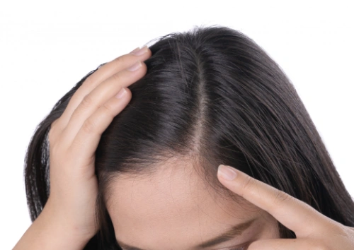 Hair Regrowth Treatments