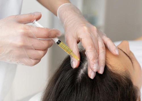 Mesotherapy for Hair