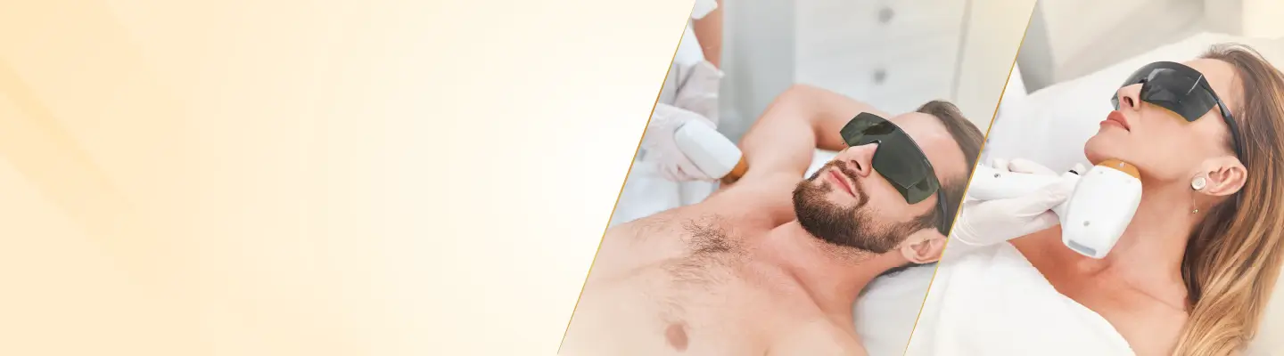 Laser Hair Removal for Male
