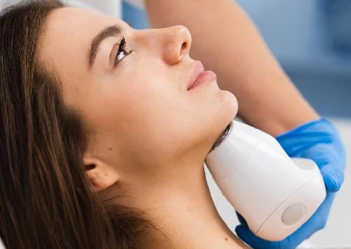 Chin Hair Removal