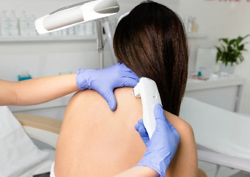 Back Laser Hair Removal